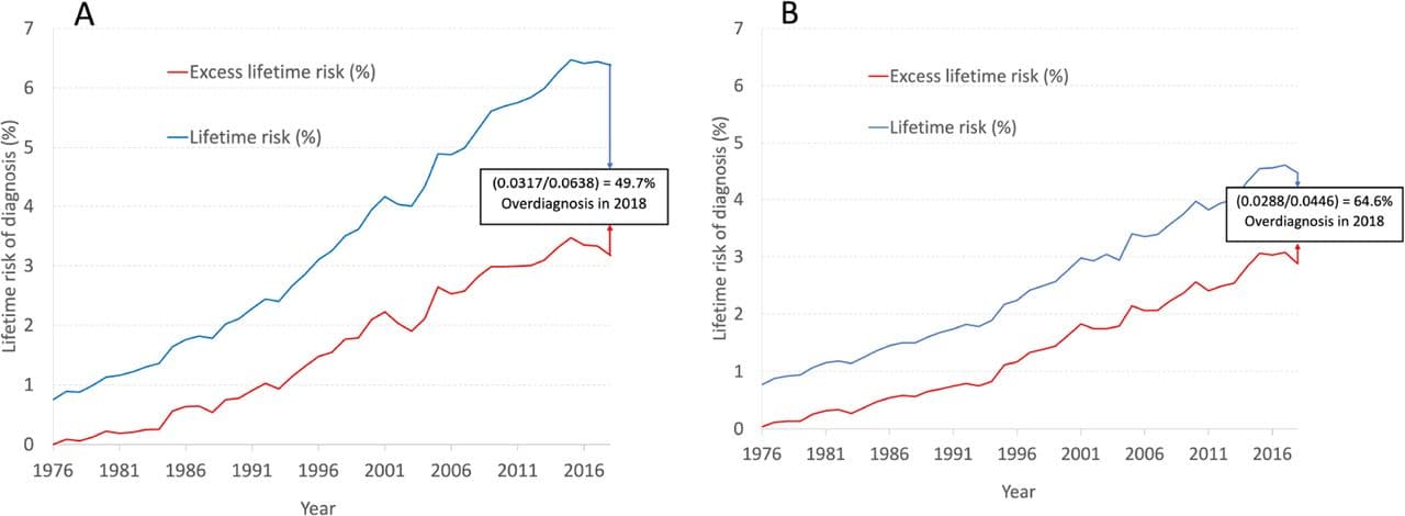Image for UK Melanoma Incidence Jumps 375% Since 1980, Fueling Overdiagnosis Debate