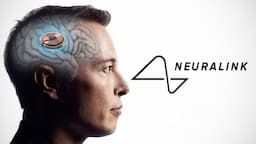 Neuralink's Human Trials Progress Amidst Growing Ethical Debates on Brain-Computer Interfaces