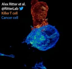 Advanced Imaging Reveals Ovarian Cancer's ESCRT-Mediated Defense Against T-Cell Assault