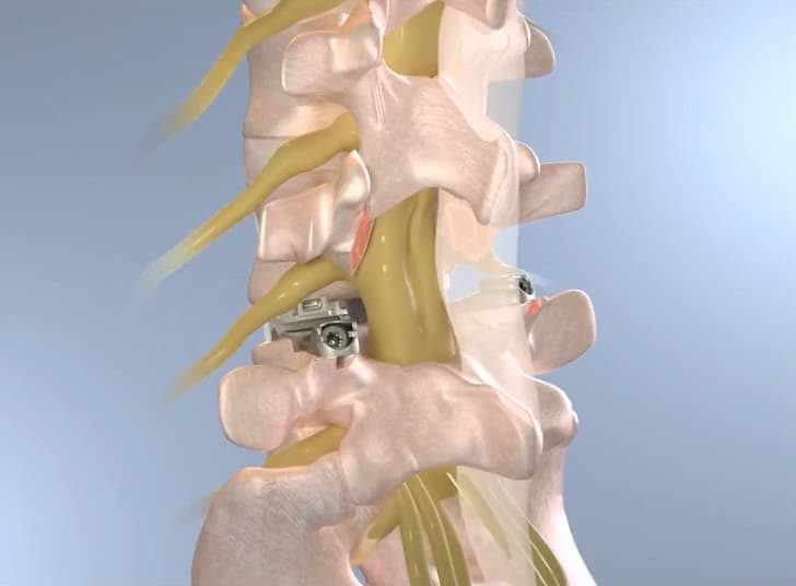 Image for 3Spine
