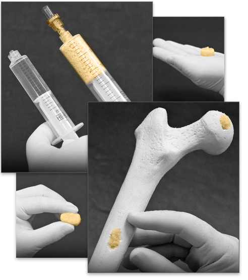 Image for Amend Surgical