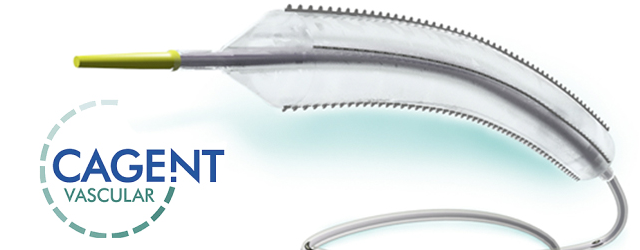 Image for Cagent Vascular