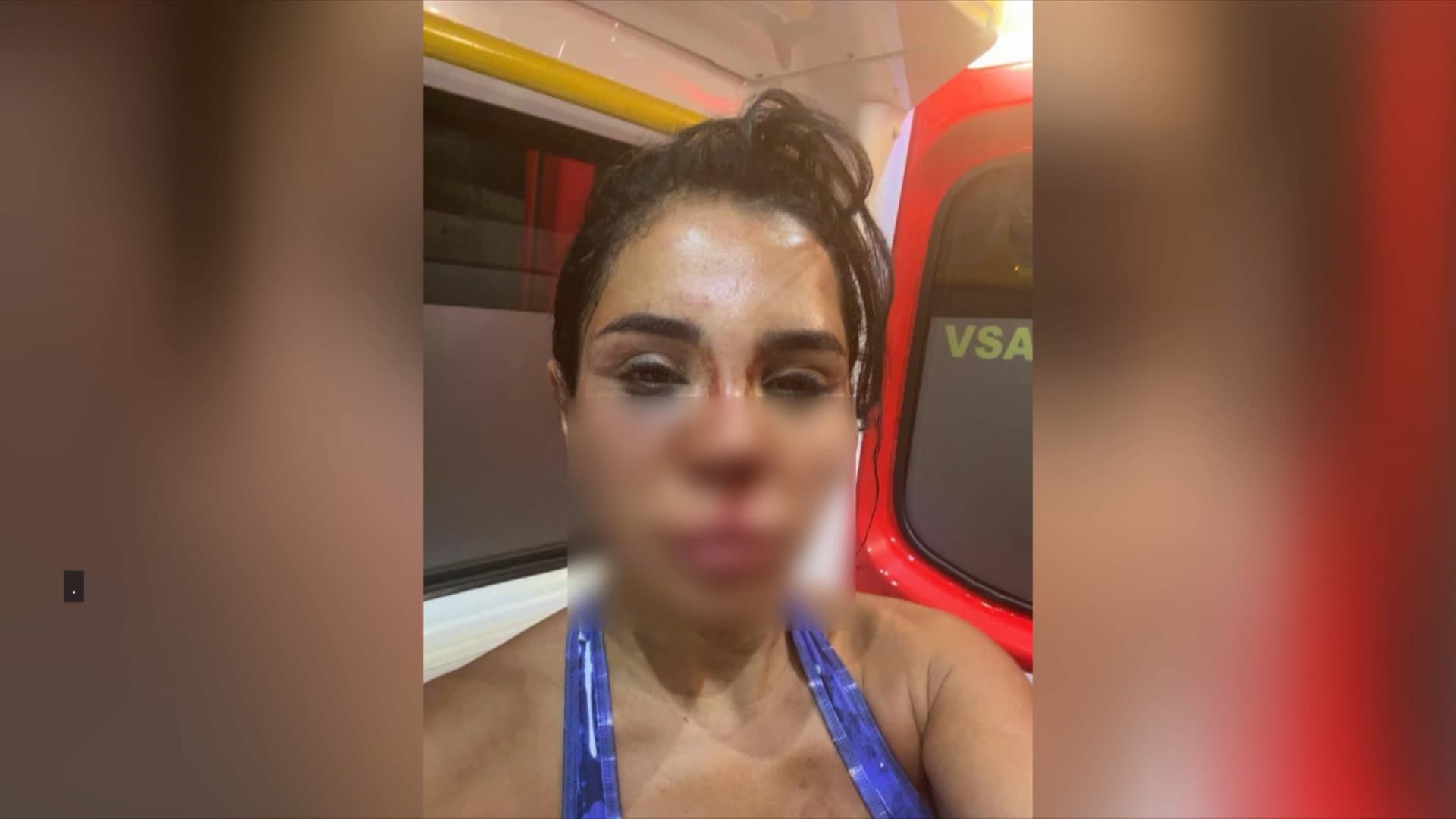 Image for French Influencer Soraya Riffy Disfigured in Brutal Marseille Home Invasion, Police Investigate