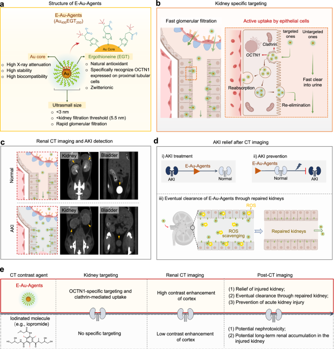 Image for Single Injection Nanoagent Shows Promise for Concurrent Kidney Imaging and Repair