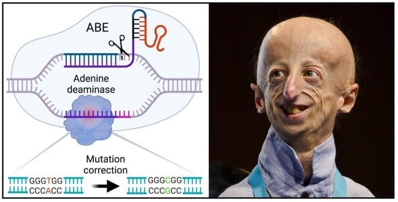 Image for Gene Editing Extends Progeria Mouse Lifespan by Over 140% as Human Trials Loom