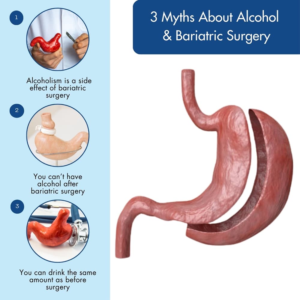 Image for Roux-en-Y Gastric Bypass Patients Face Doubled Alcohol Use Disorder Risk After Two Years