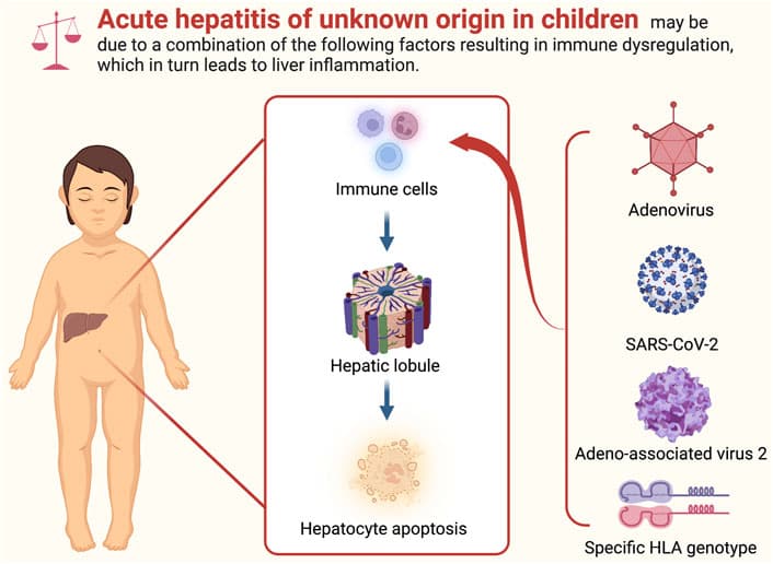 Image for Study Links AAV2 Co-infection to Severe Acute Hepatitis in Children